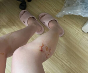小心貓咪尖銳的爪子
